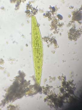 Image of Closterium acerosum f. lanceolatum