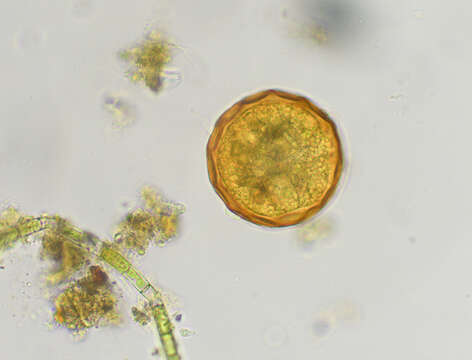 Image of Arcella gibbosa