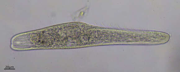 Слика од Spirostomum teres