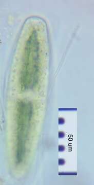 Image of Netrium (Naegeli) Itzigsohn & Rothe 1856