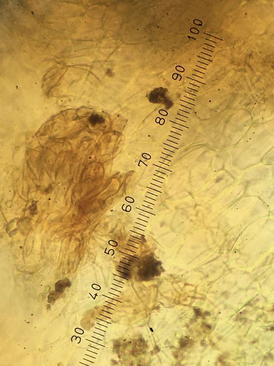 Anthracobia macrocystis (Cooke) Boud. 1907的圖片