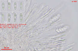 Image of Leptodontidium trabinellum (P. Karst.) Baral, Platas & R. Galán 2015