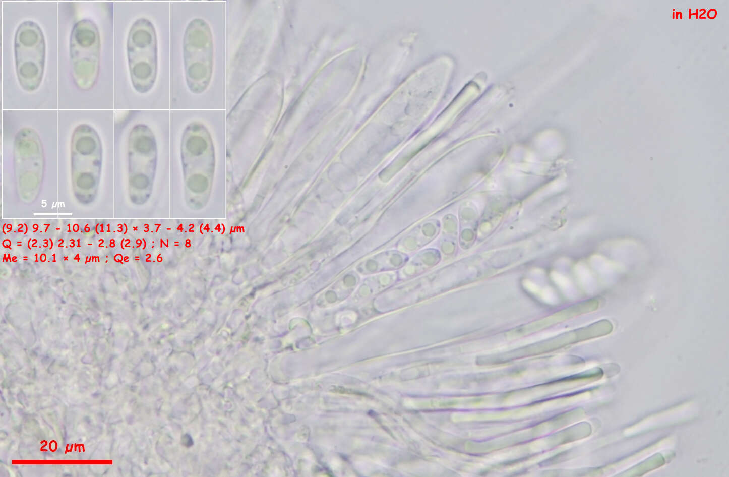 Image of Leptodontidium trabinellum (P. Karst.) Baral, Platas & R. Galán 2015