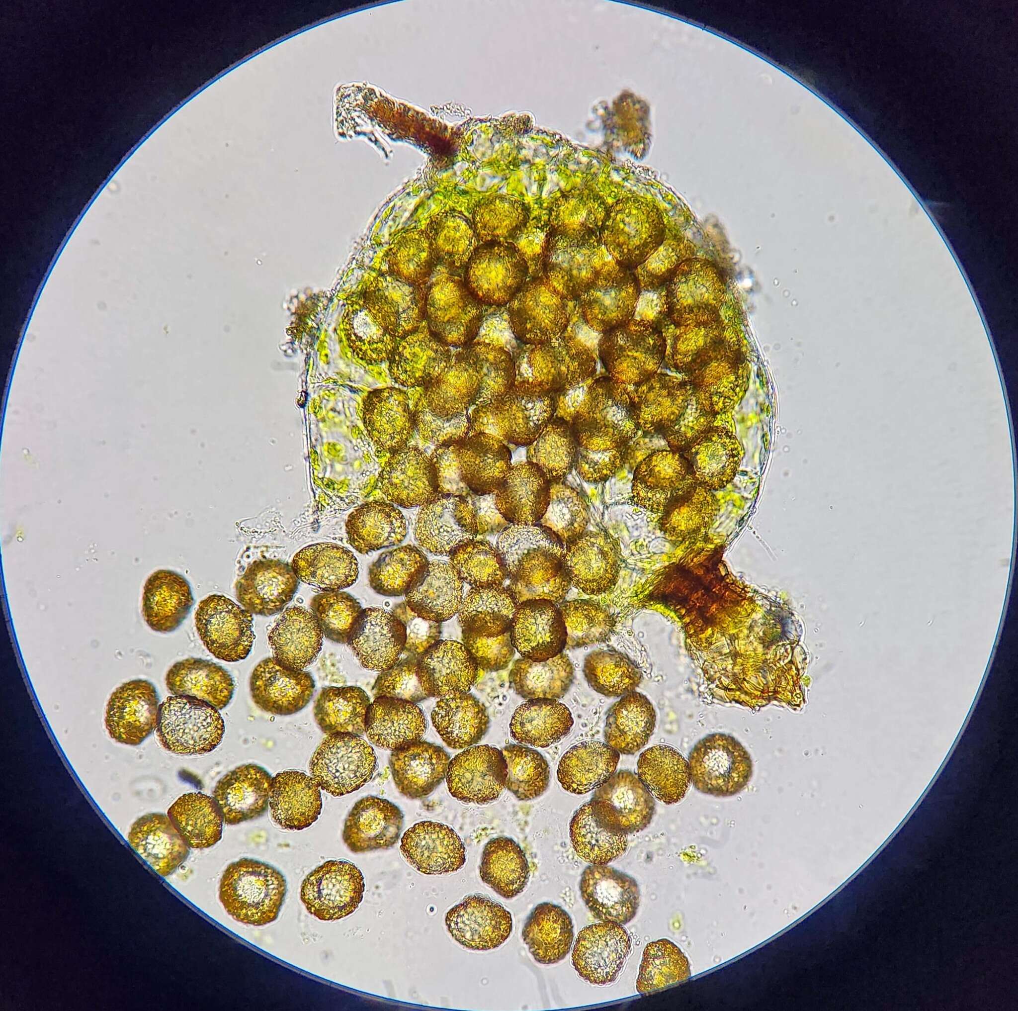 Image of micromitrium moss