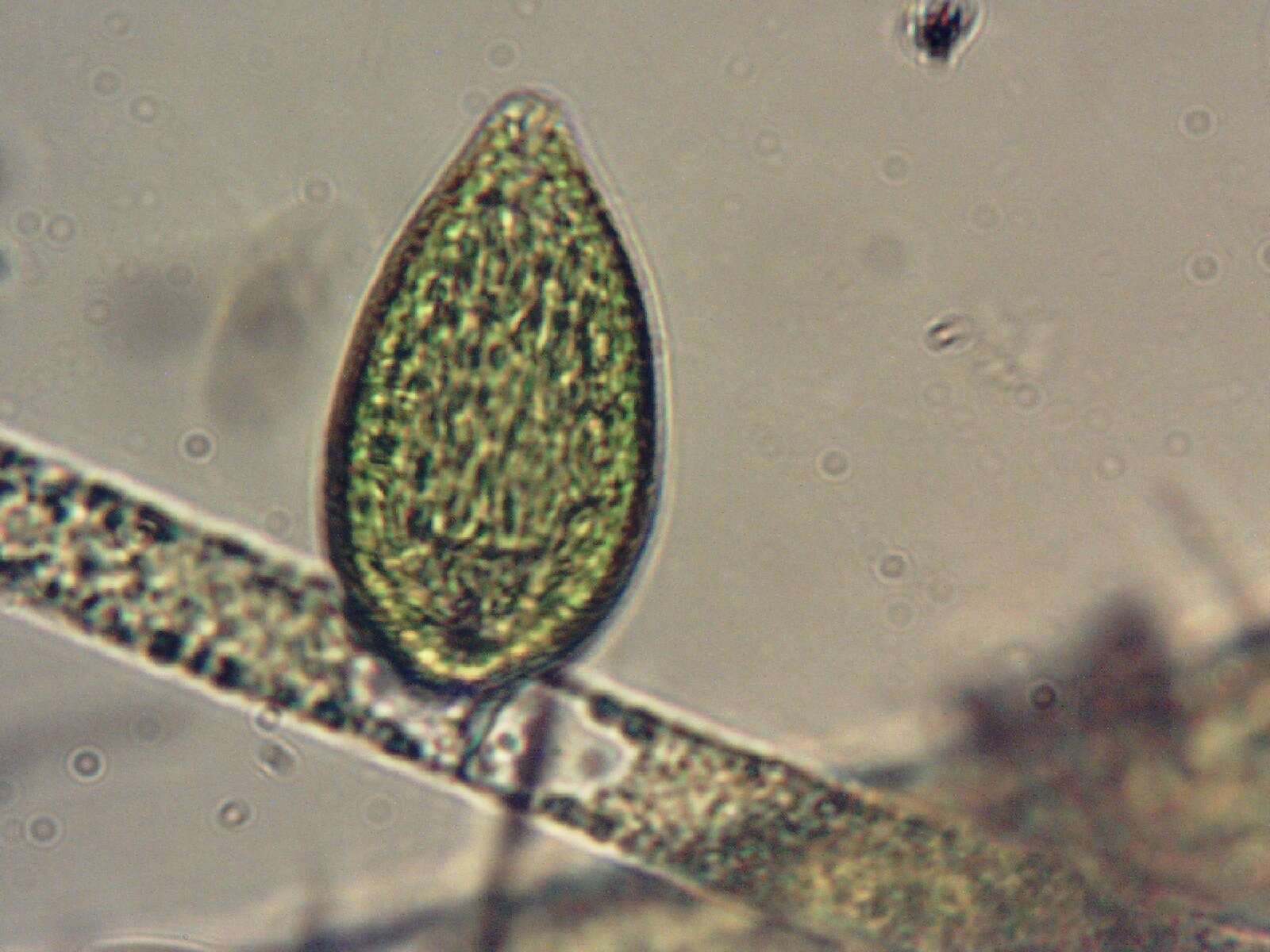 Image of Gonyostomum semen