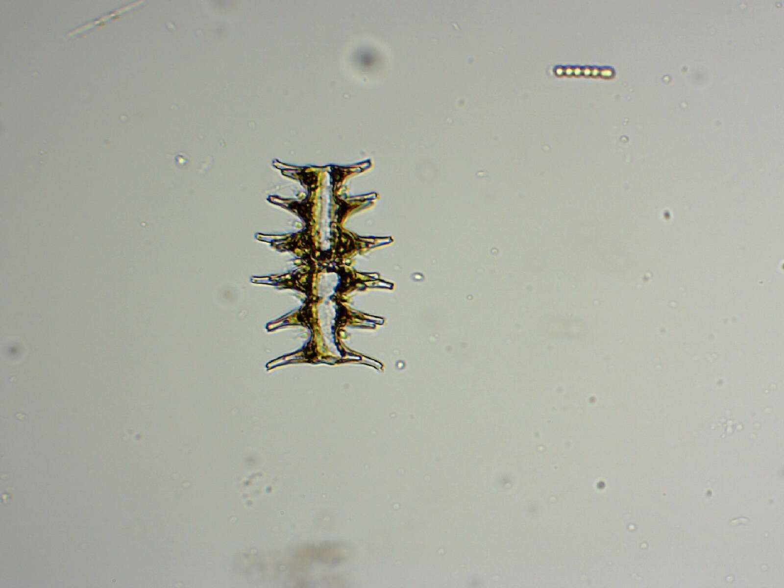 Image of Micrasterias muricata