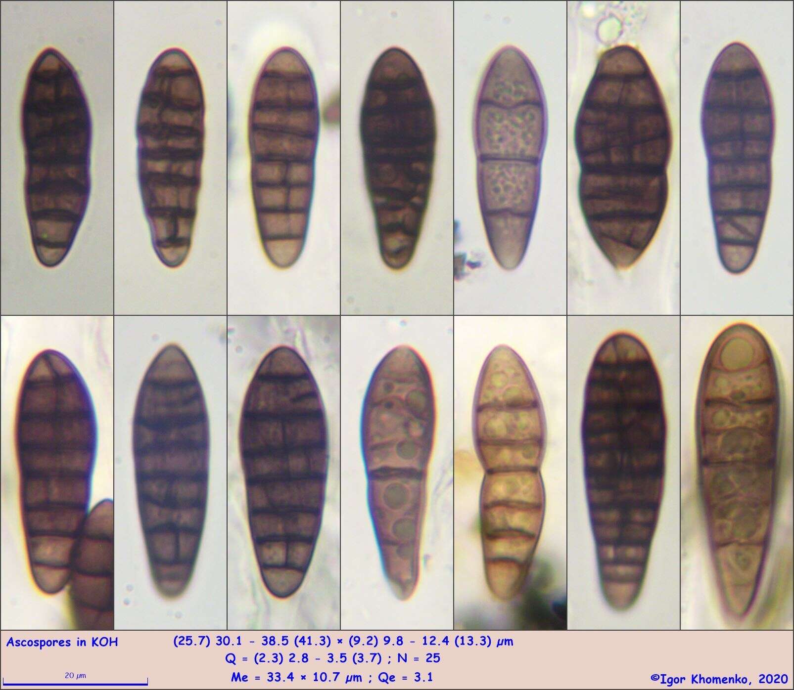 Image of Gloniopsis subrugosa (Cooke & Ellis) E. Boehm & C. L. Schoch 2009