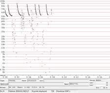 صورة Lasiurus blossevillii (Lesson & Garnot 1826)