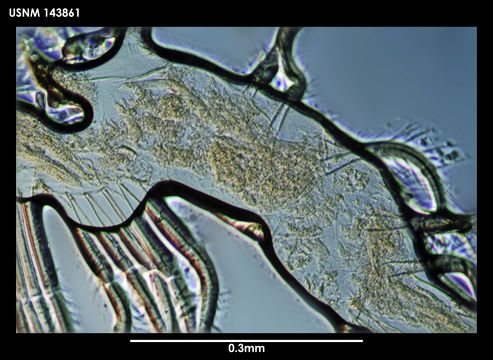 Image of <i>Thaumatoconcha punctata</i> Kornicker & Sohn 1976
