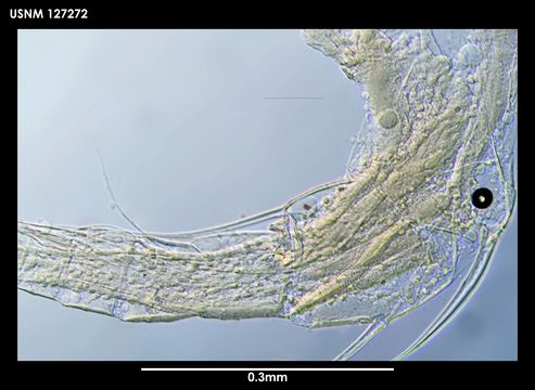 Image of <i>Thaumatoconcha radiata</i> Kornicker & Sohn 1976