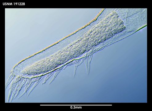 Image of <i>Ascothorax sosci</i> Grygier 1983