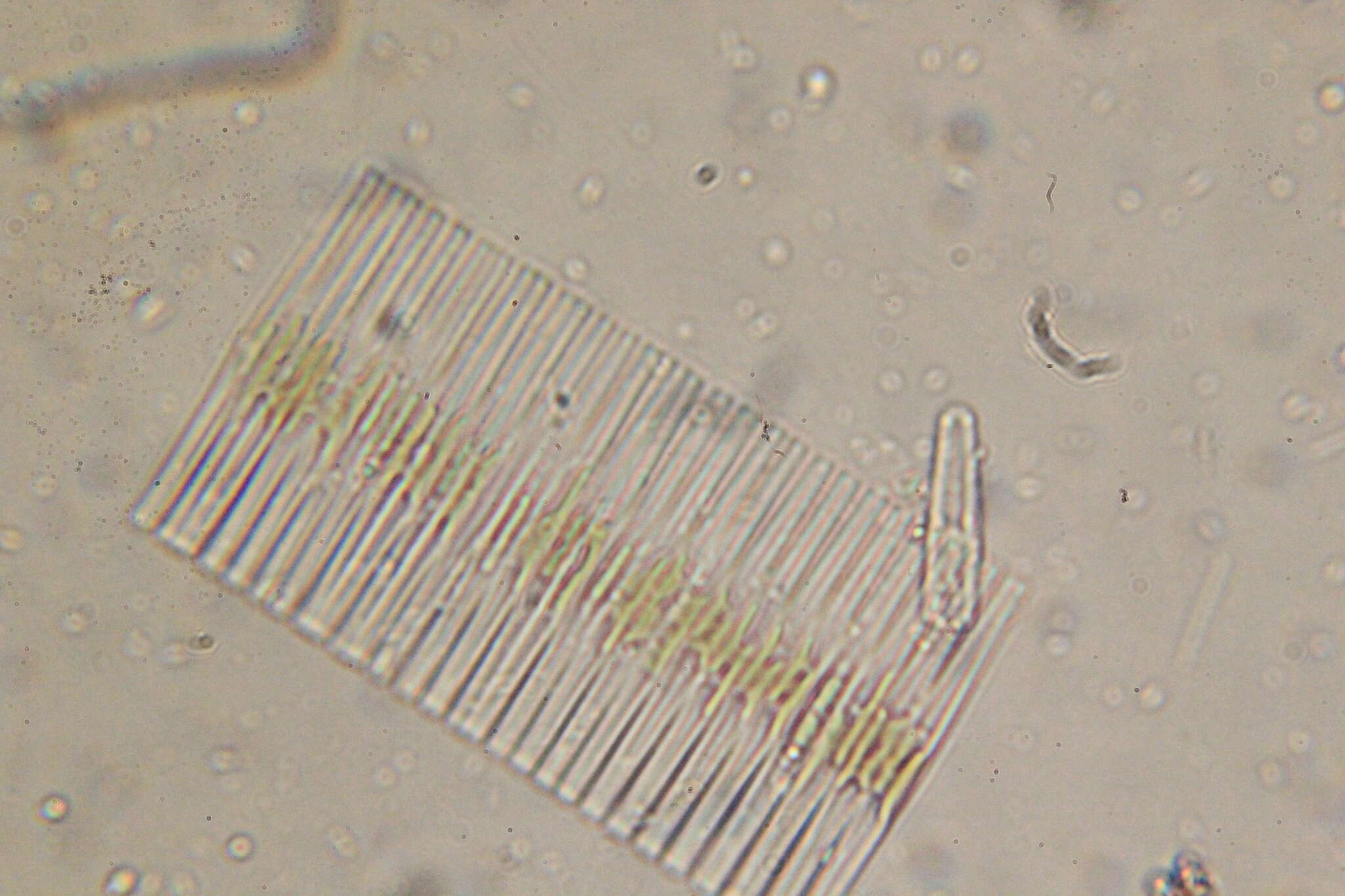 Imagem de Fragilaria crotonensis