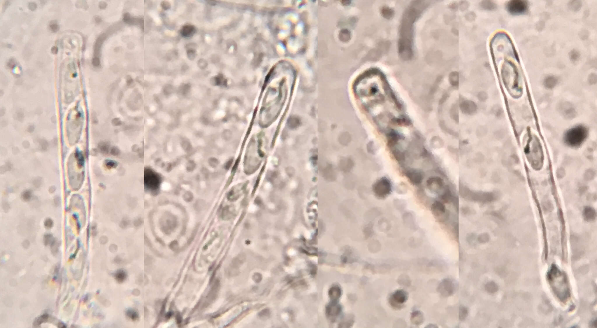 Image of Orbilia carpoboloides (P. Crouan & H. Crouan) Baral 1994