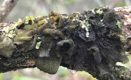 Image of skin lichen