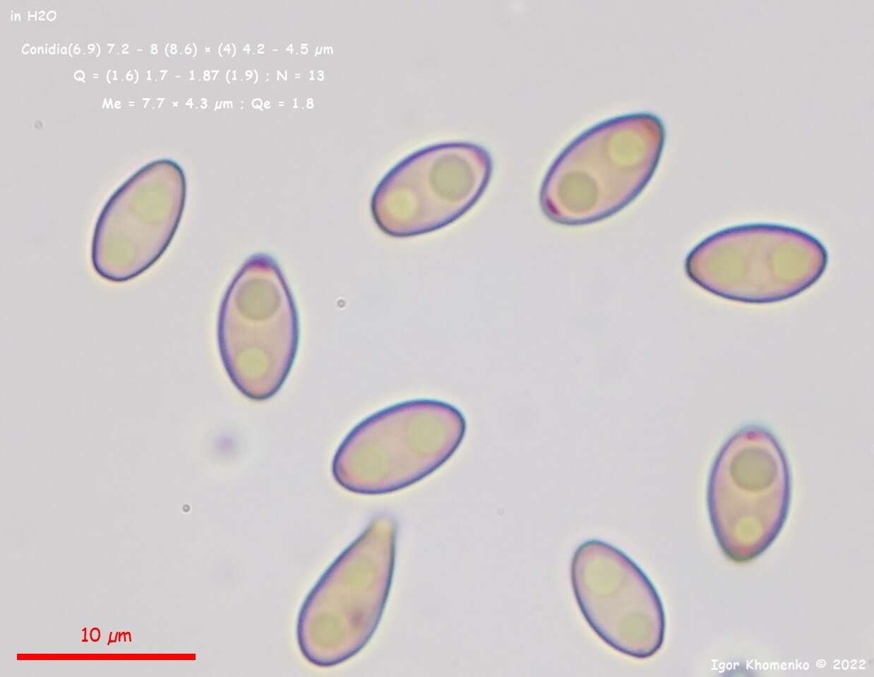 Слика од Immotthia atrograna (Cooke & Ellis) M. E. Barr 1993