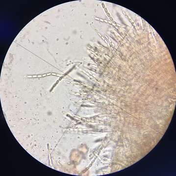 Image of Phomatospora coprophila M. J. Richardson 1972