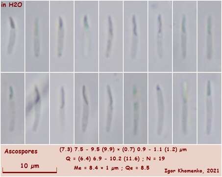 Image de Orbilia sinensis (Z. F. Yu & K. Q. Zhang) Baral, Z. F. Yu & E. Weber 2015