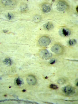 Image of wart lichen