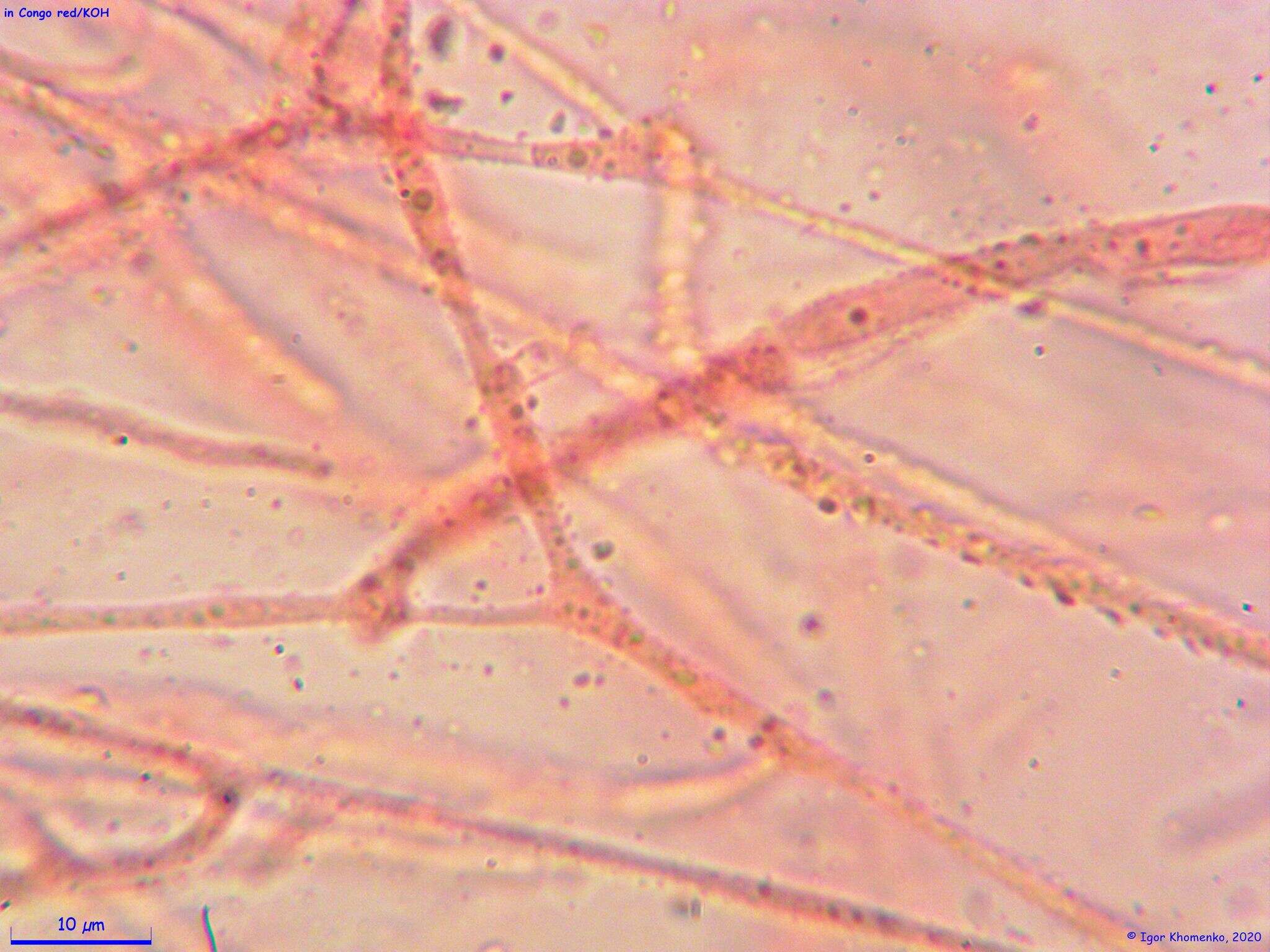 Ditangium cerasi (Schumach.) Costantin & L. M. Dufour 1891 resmi