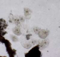 Image of Conochilus (Conochilus) hippocrepis (Schrank 1803)