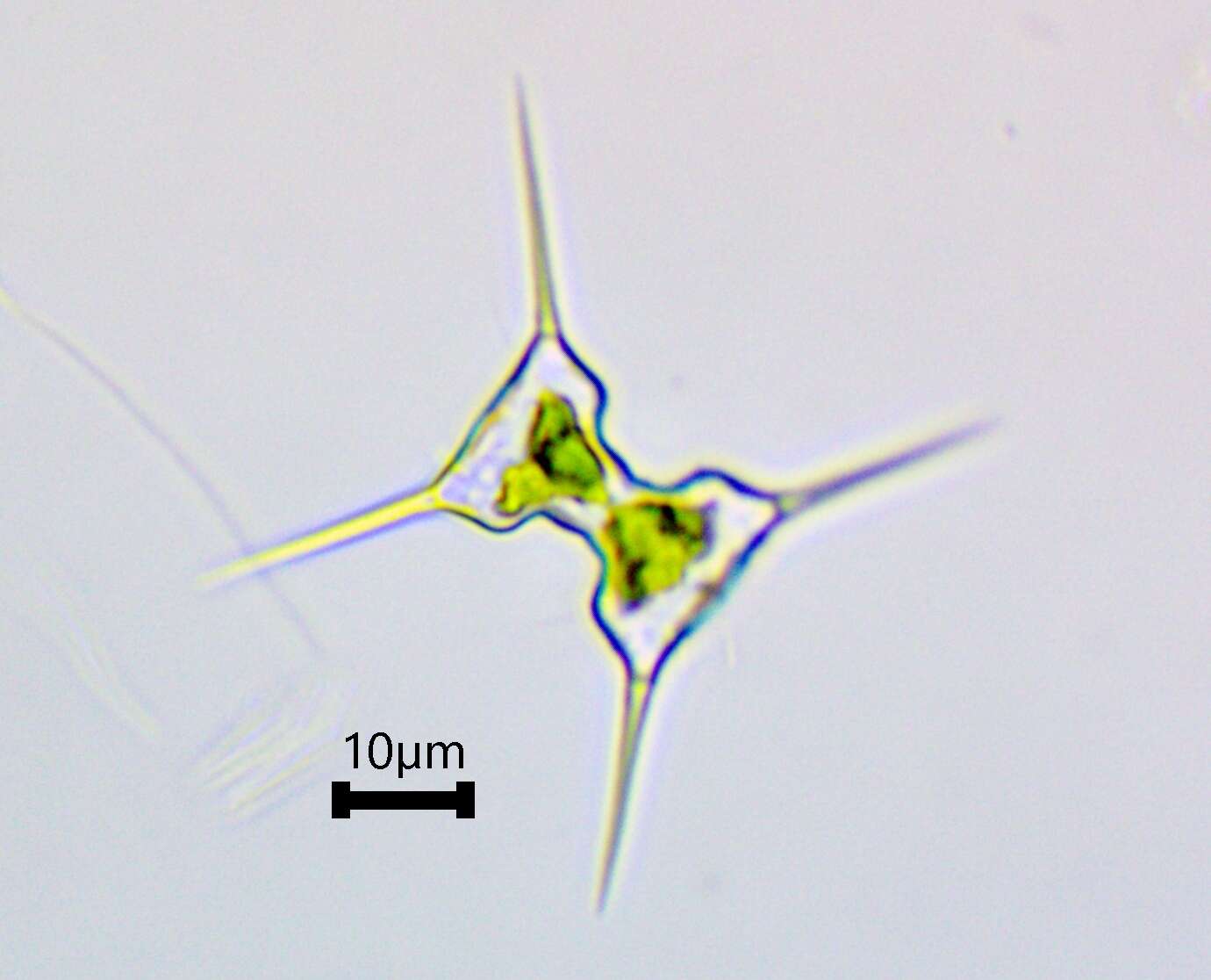 Imagem de Staurodesmus extensus