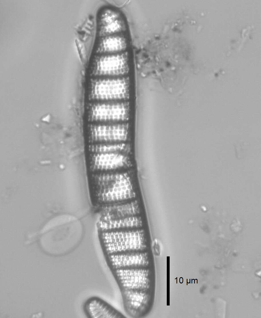 Image of Epithemia adnata (Kützing) Brébisson 1838