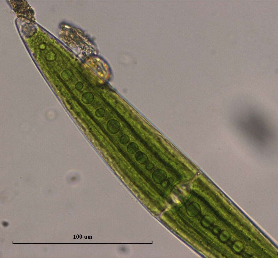 Слика од Closterium acerosum f. lanceolatum