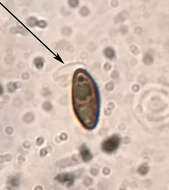 صورة Hypomontagnella submonticulosa