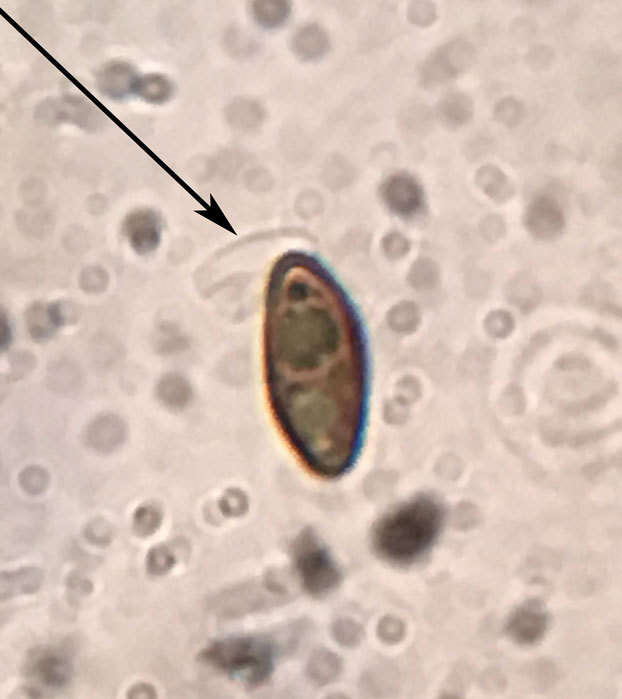 Слика од Hypomontagnella submonticulosa