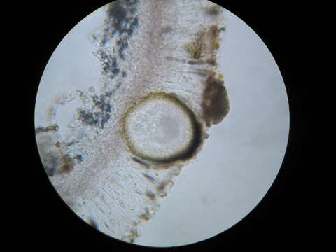 Plancia ëd Didymocyrtis epiphyscia Ertz & Diederich 2015