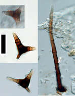 صورة Triposporium verruculosum R. F. Castañeda, Gené & Guarro 1996