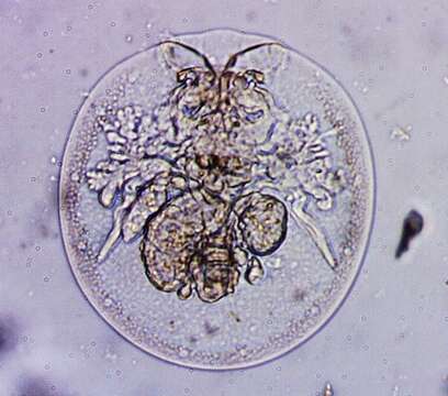 Image of turtle rotifer