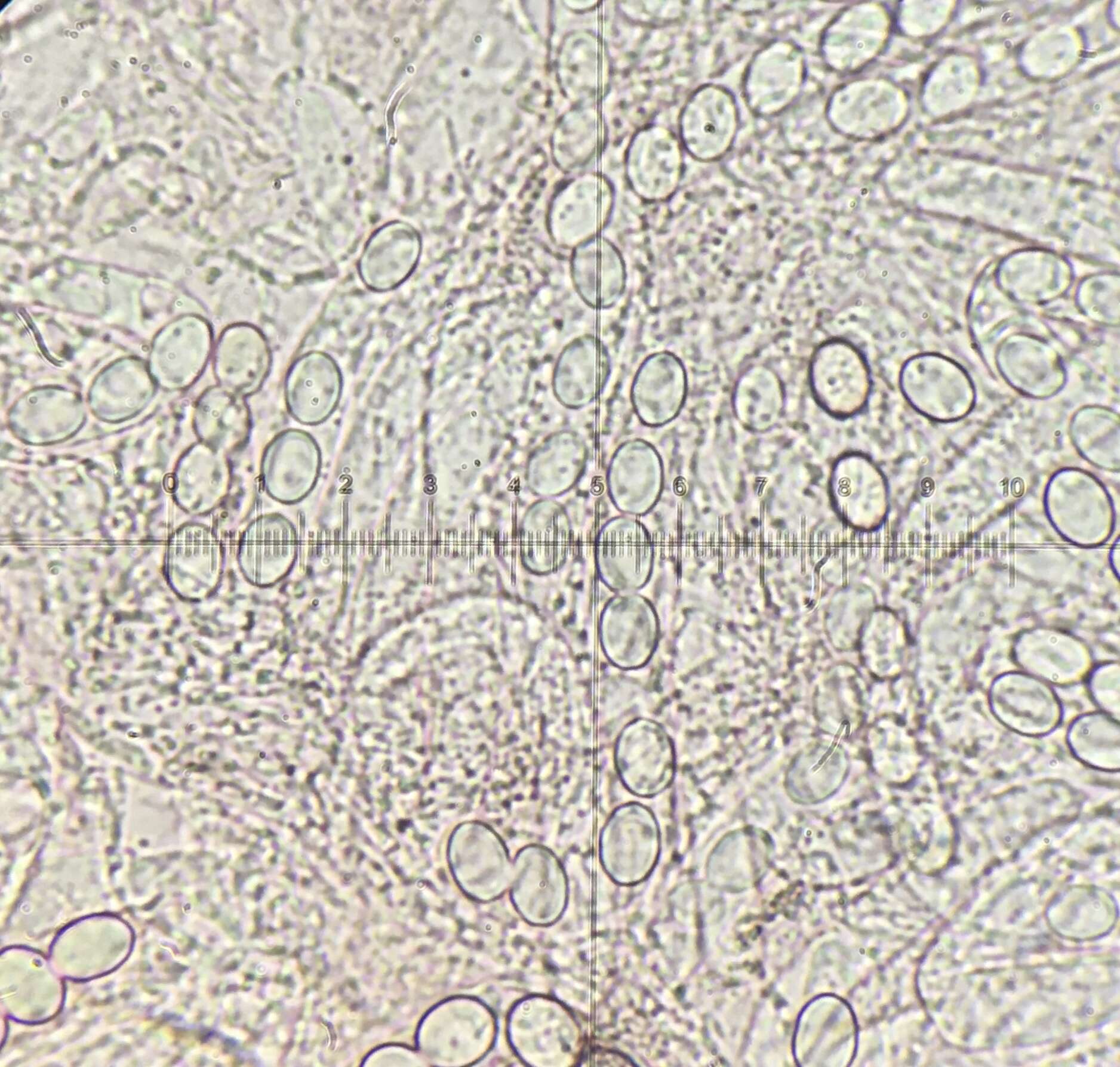 Image de Lasiobolus microsporus J. L. Bezerra & Kimbr. 1975