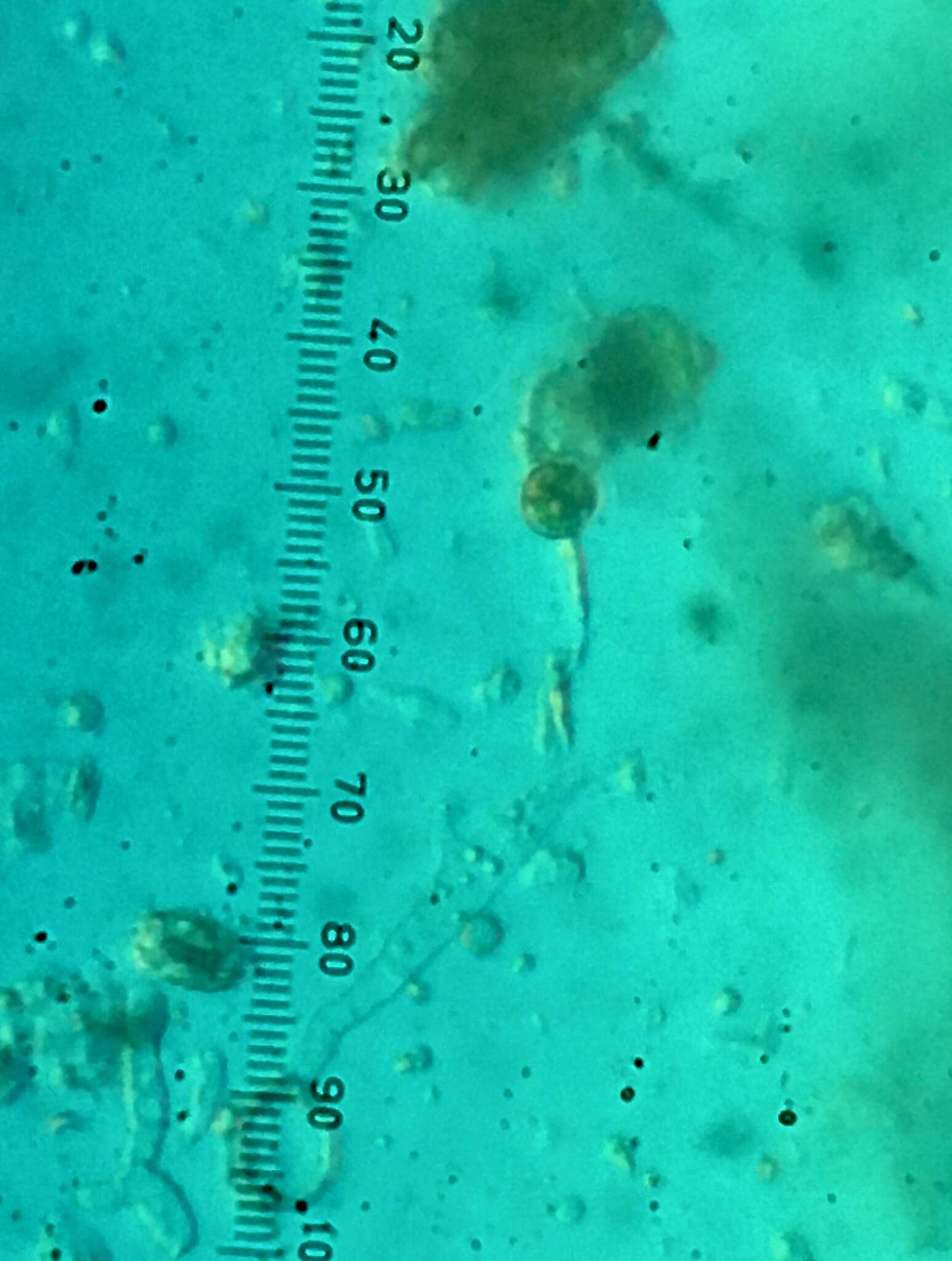 Image of Septobasidium canescens Burt 1916