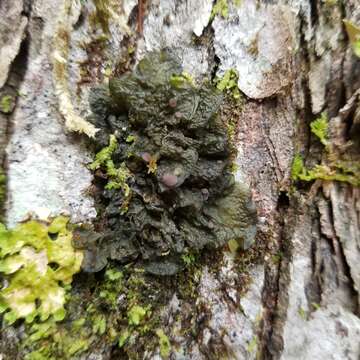 Image of skin lichen