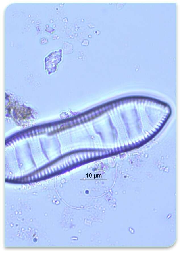 Image of Surirella librile Ehrenberg