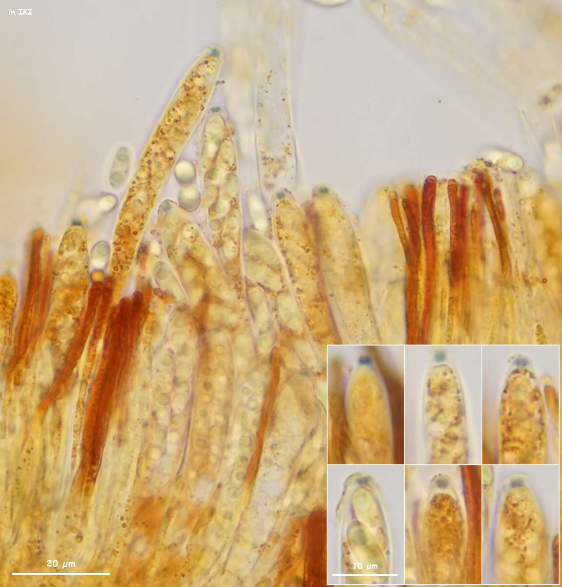 Image of Leptodontidium trabinellum (P. Karst.) Baral, Platas & R. Galán 2015