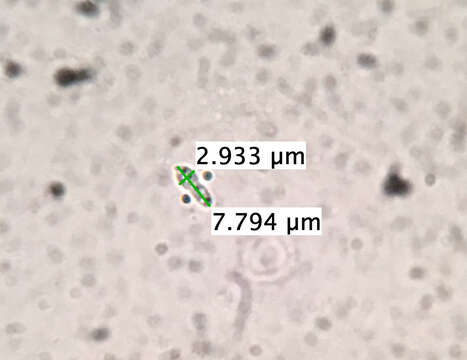 Слика од Anteaglonium globosum Mugambi & Huhndorf 2009