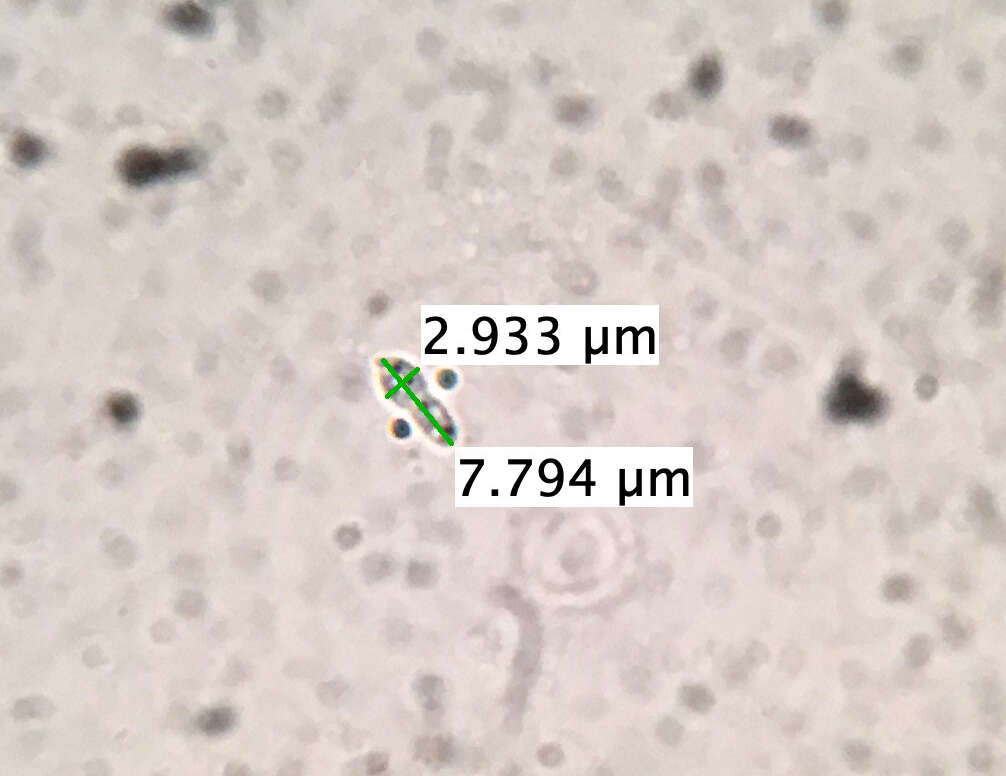 Image of Anteaglonium globosum Mugambi & Huhndorf 2009