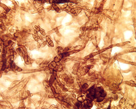 Image of Chaetasbolisia falcata V. A. M. Mill. & Bonar 1941