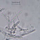 Eupezizella aureliella (P. Karst.) T. Kosonen, Huhtinen & K. Hansen的圖片