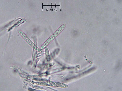 Eupezizella aureliella (P. Karst.) T. Kosonen, Huhtinen & K. Hansen的圖片