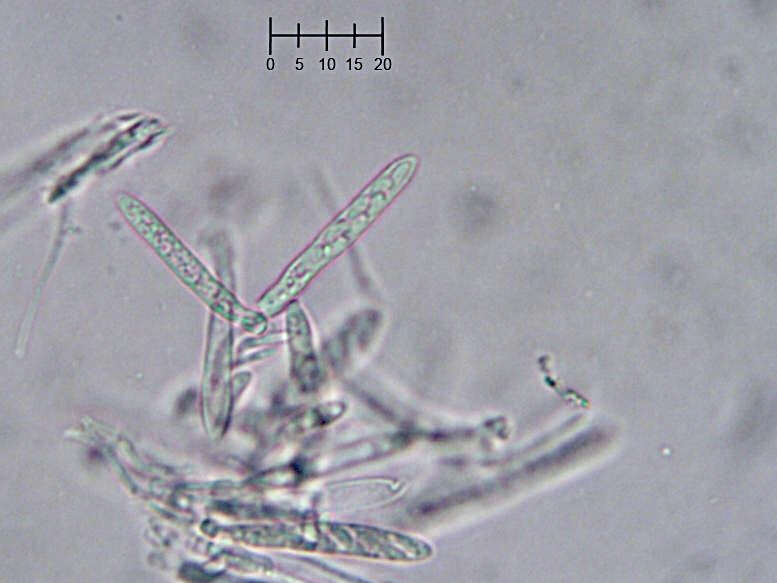 Image of Eupezizella aureliella (P. Karst.) T. Kosonen, Huhtinen & K. Hansen