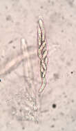 Echinosphaeria strigosa (Alb. & Schwein.) Declercq 2009的圖片