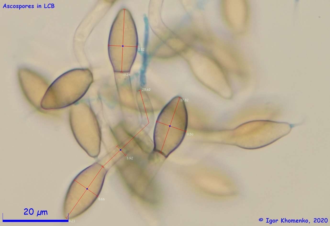 Plancia ëd Immersiella caudata (Sacc.) A. N. Mill. & Huhndorf 2004