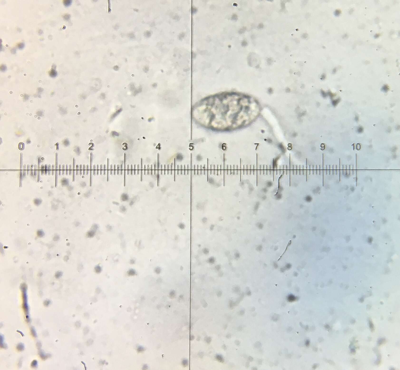 Image of Podospora leporina (Cain) Cain 1962