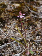 Image of White fingers