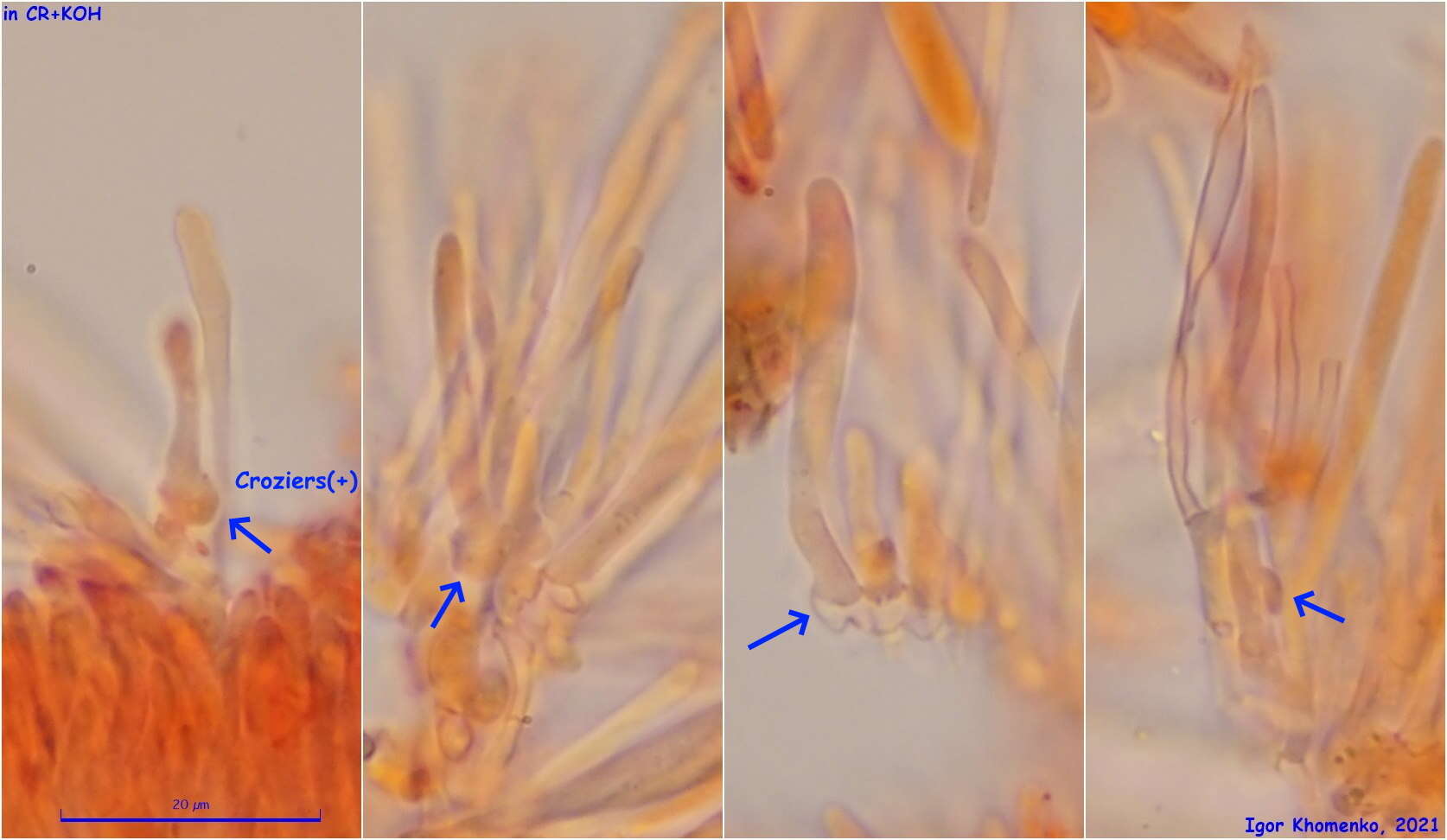 صورة Tapesia lividofusca (Fr.) Rehm 1891