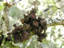 Image of skin lichen