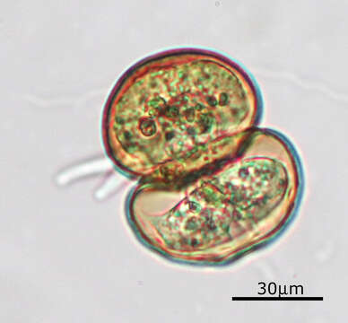 صورة Arcella hemisphaerica